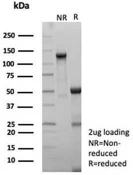 Recombinant Pan-HLA-II (DP, DQ, DR) Antibody