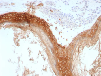 KRT76 Antibody