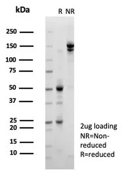 KDM5C Antibody
