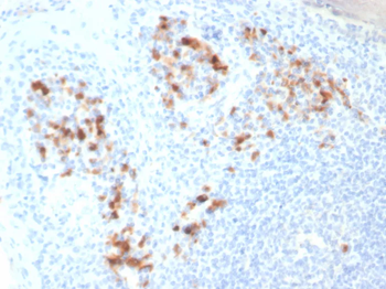 CD138 / Syndecan-1 (SDC1) (Plasma Cell Marker) Antibody