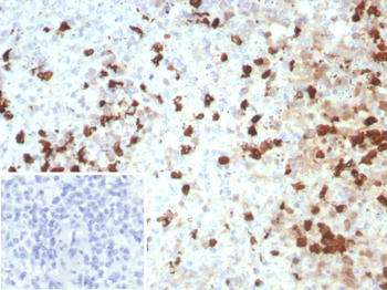 S100A12 Antibody