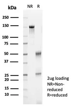 S100A12 Antibody