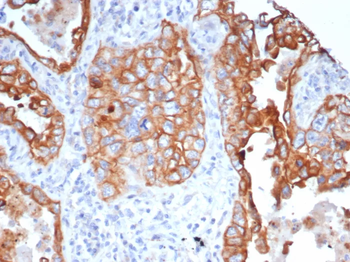 L1TD1 Antibody