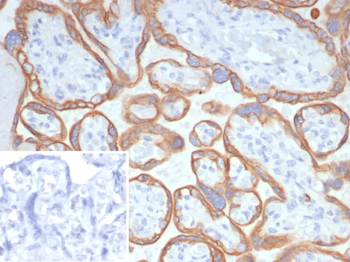 L1TD1 Antibody