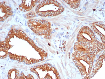 L1TD1 Antibody
