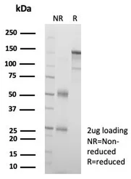 L1TD1 Antibody