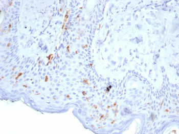 CD207 Antibody