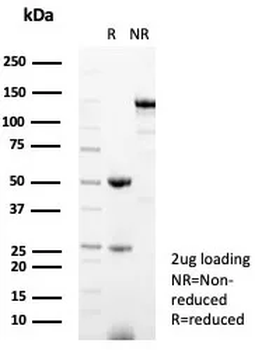 KLK5 Antibody