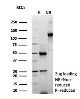POSTN Antibody