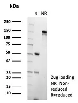 EBI3 Antibody