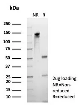 EBI3 Antibody