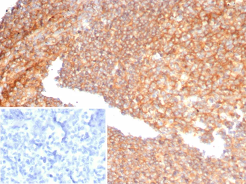 SERPINA1 Antibody
