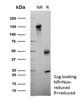 SERPINA1 Antibody