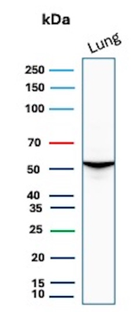 SERPINA1 Antibody