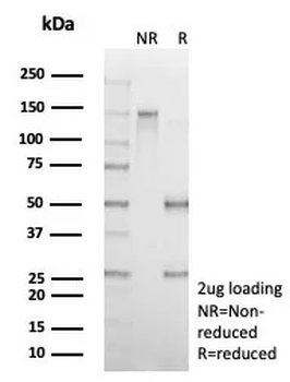 SERPINA1 Antibody