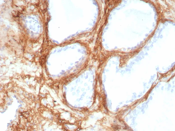 POSTN Antibody