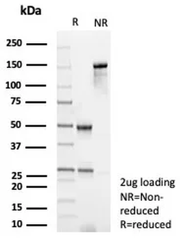 POSTN Antibody