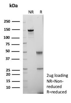 Recombinant Galectin-3 (LGALS3) (Thyroid Cell Marker) Antibody