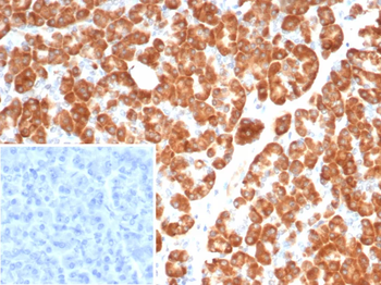 IL18 Antibody
