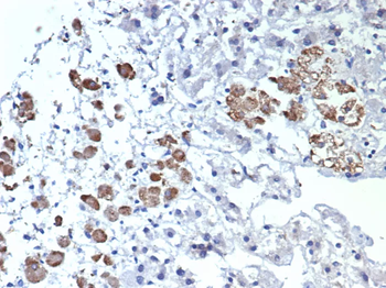 IL-2 Antibody