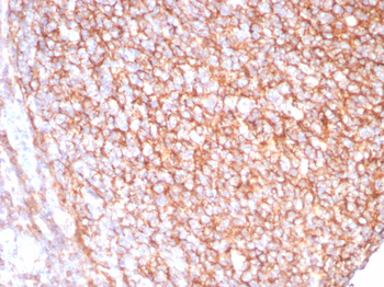 CR2 Antibody