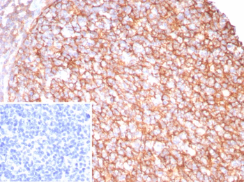 CR2 Antibody