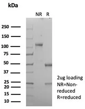 CR2 Antibody