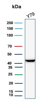CKB Antibody