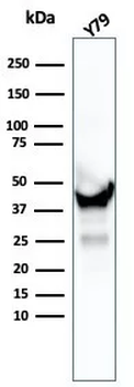 CKB Antibody