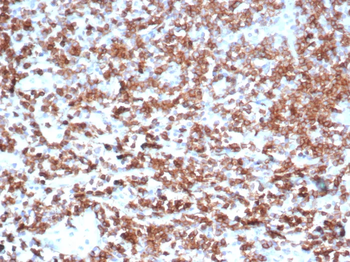CD39 Antibody