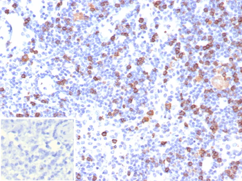 Recombinant CD8A (Cytotoxic / Suppressor T-Cell Marker) Antibody