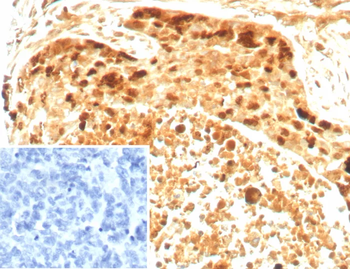 BIRC5 Antibody