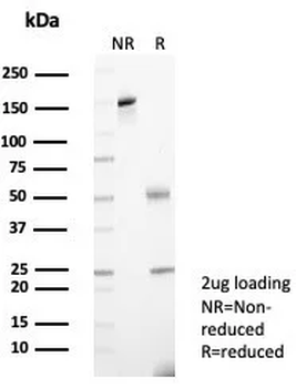 A2M Antibody