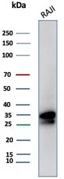 Recombinant CD20 / MS4A1 (B-Cell Marker) Antibody