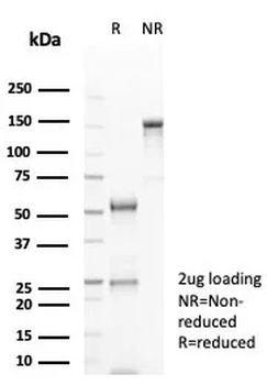 Recombinant CD20 / MS4A1 (B-Cell Marker) Antibody