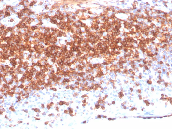 CD7 Antibody