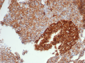 CD99 Antibody