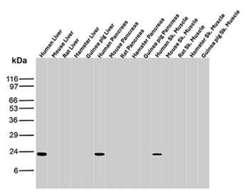 MGMT Antibody