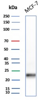 MGMT Antibody