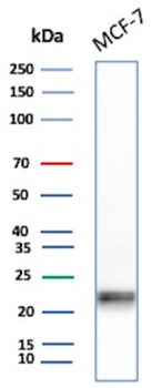MGMT Antibody