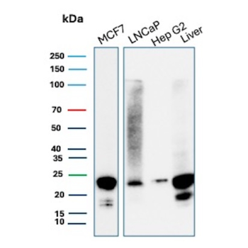 MGMT Antibody