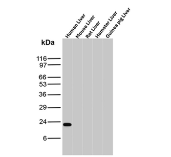 MGMT Antibody