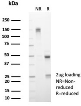 IL15 Antibody