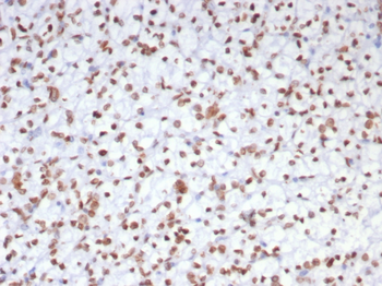 EZH2 Antibody