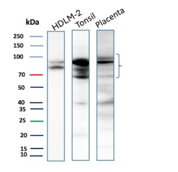 EZH2 Antibody