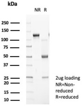HLA-DPB1 Antibody