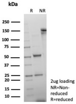 Recombinant Double Stranded DNA (dsDNA) (Nuclear Marker) Antibody