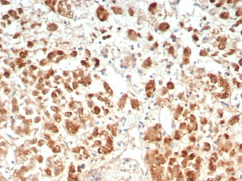 IL18R1 Antibody