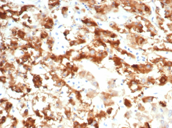 IL18R1 Antibody