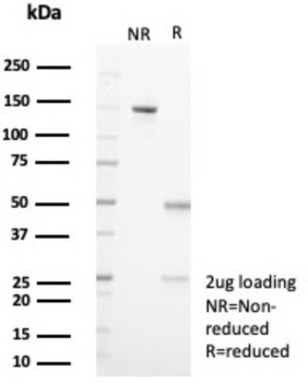 IL18R1 Antibody